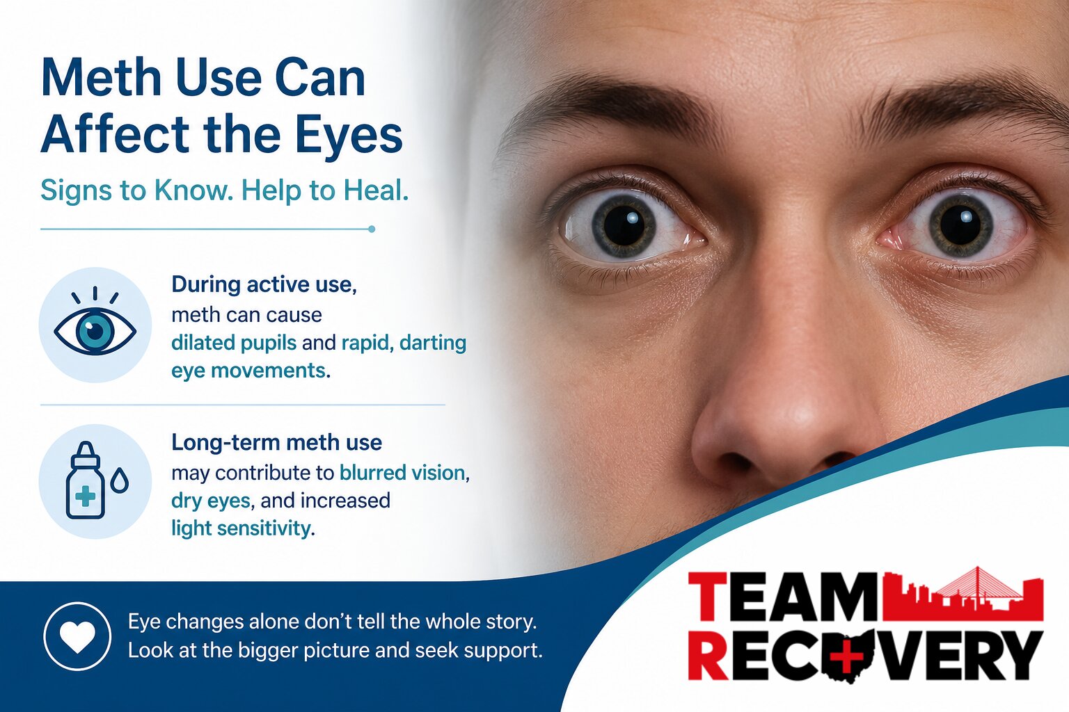 Meth Eyes Signs, Vision Changes & What They Mean